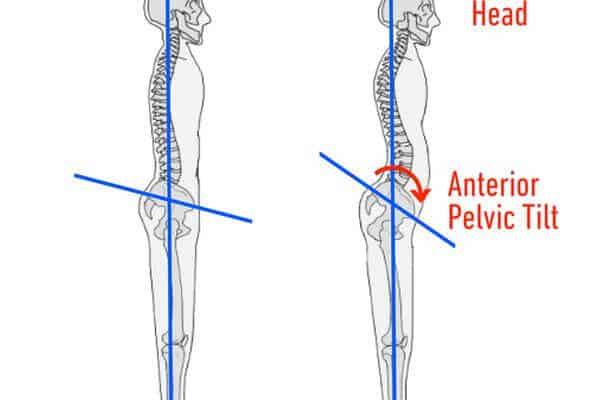 9. anterior pelvic tilt